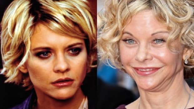 Meg-Ryan-Plastic-Surgery-Before-and-After.jpg