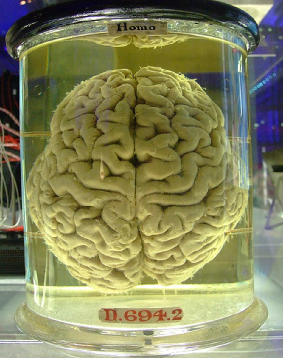 Human brain - please add comment and fav this if you blog with it. by Gaetan Lee.