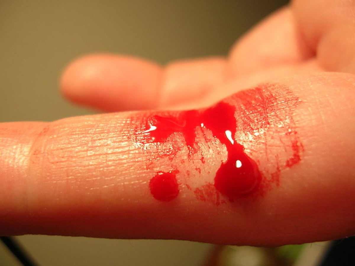 http://upload.wikimedia.org/wikipedia/commons/thumb/e/e6/Bleeding_finger.jpg/800px-Bleeding_finger.jpg